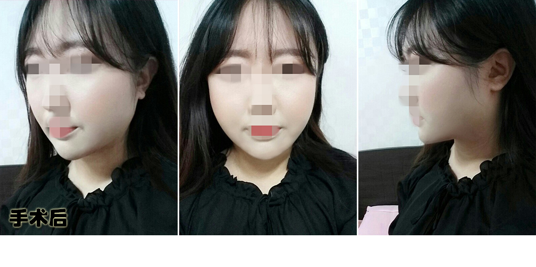 정미희_후.jpg
