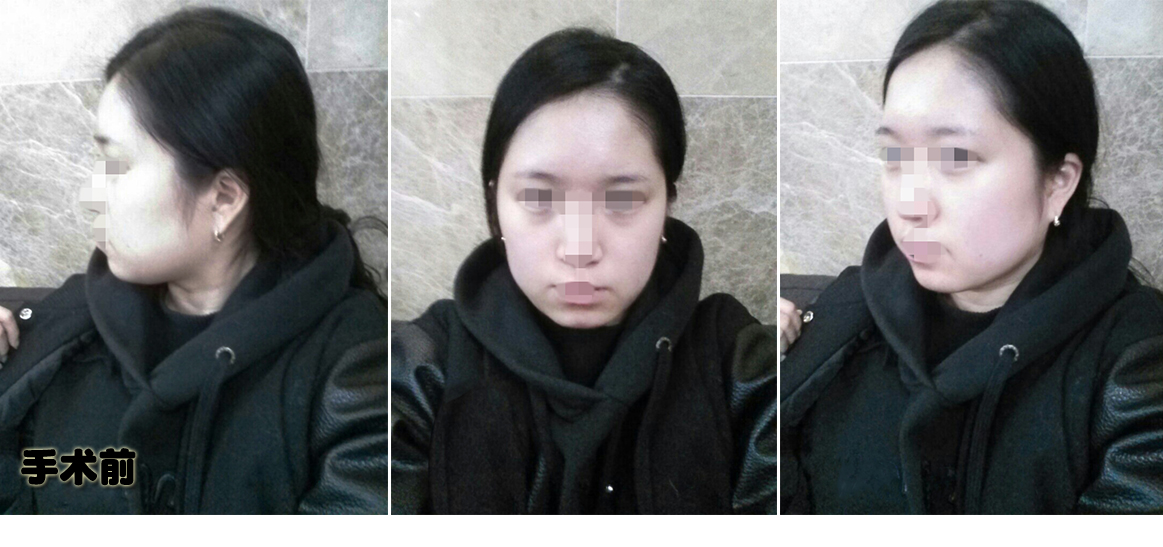 전.jpg
