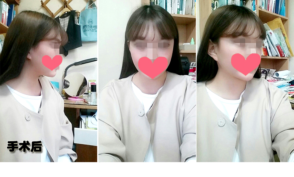 후.jpg