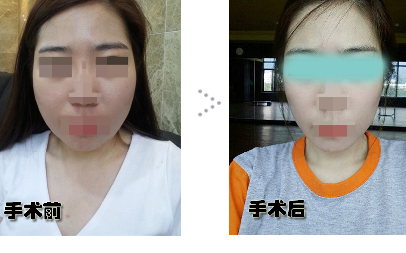 전후1.jpg