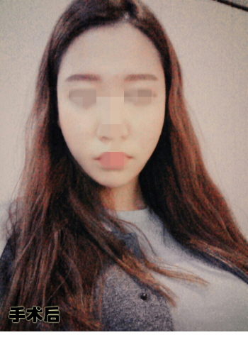 크기변환_연아영_2회_후.jpg
