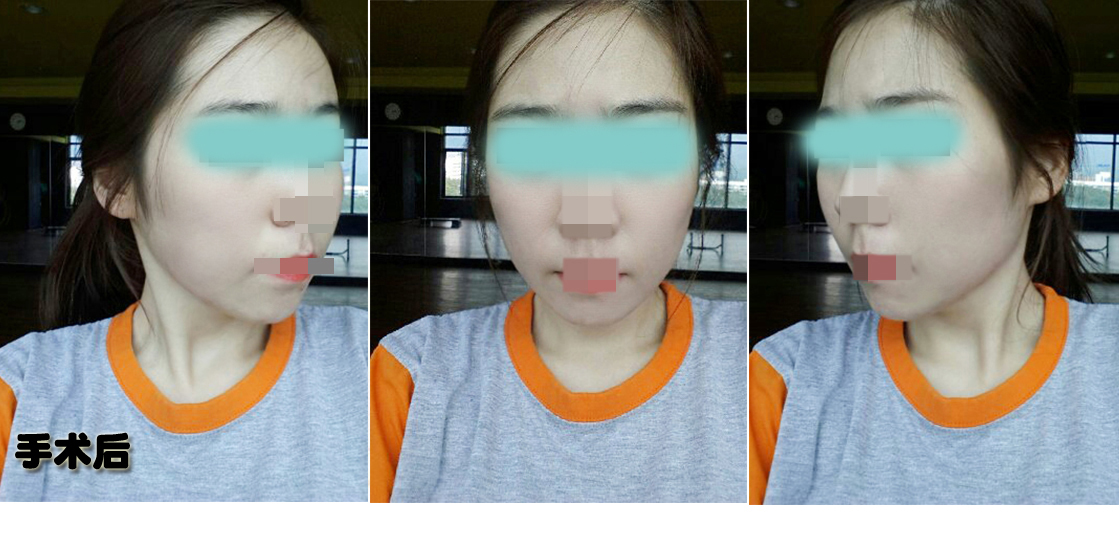 후1.jpg