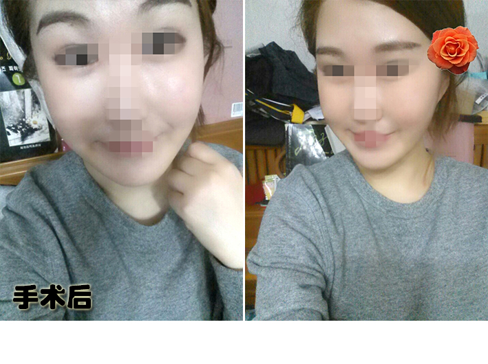 임노엘_후.jpg