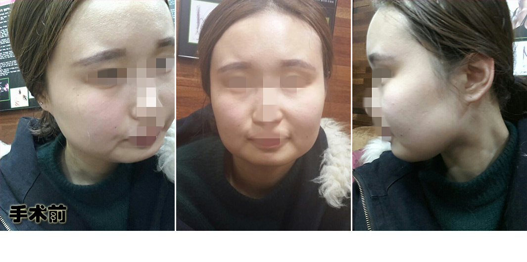 전.jpg