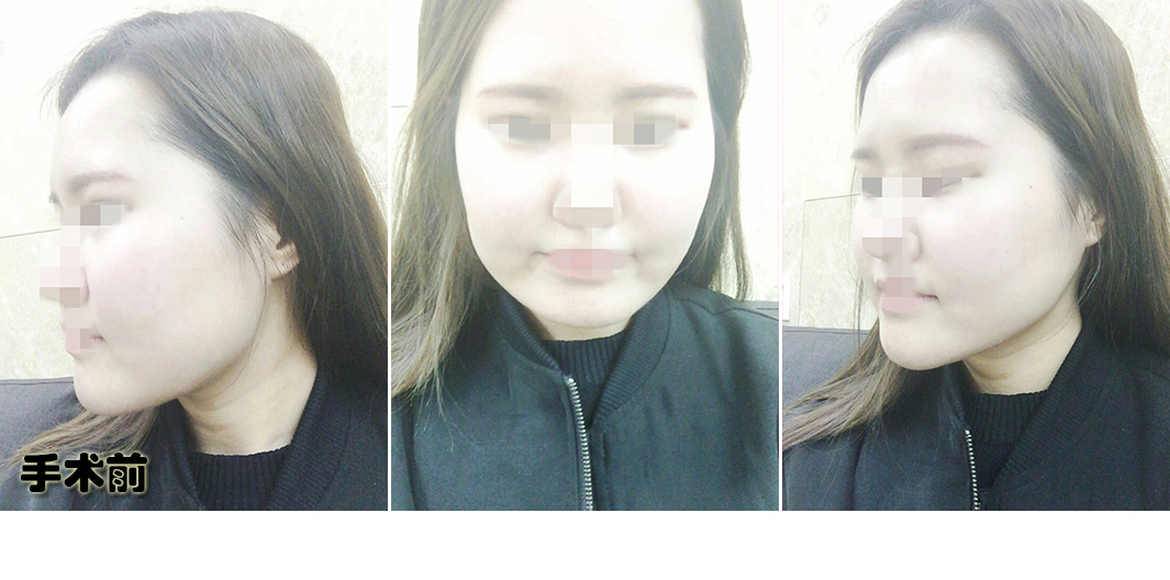 장혜림_전_포스팅.jpg
