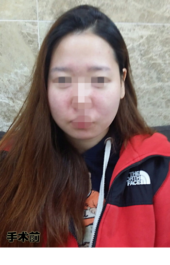 크기변환_연아영_2회_전.jpg
