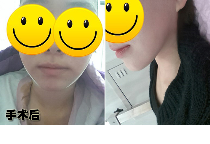 나노이름없음_후.jpg
