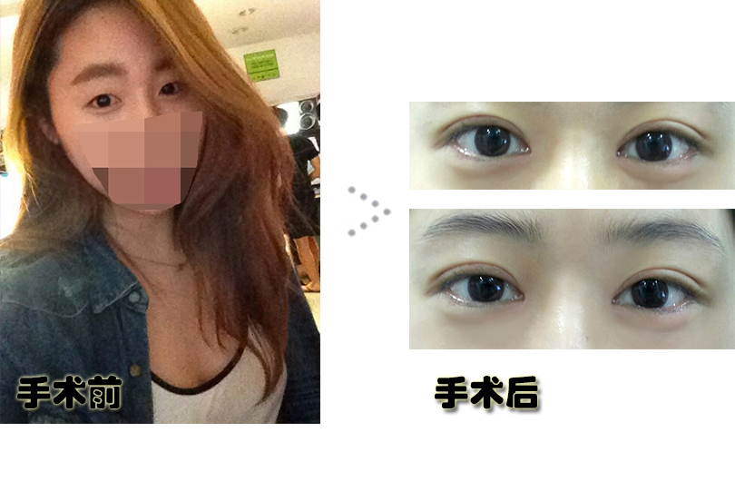 오지은_전후.jpg
