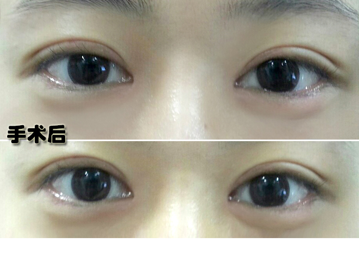 오지은_후.jpg