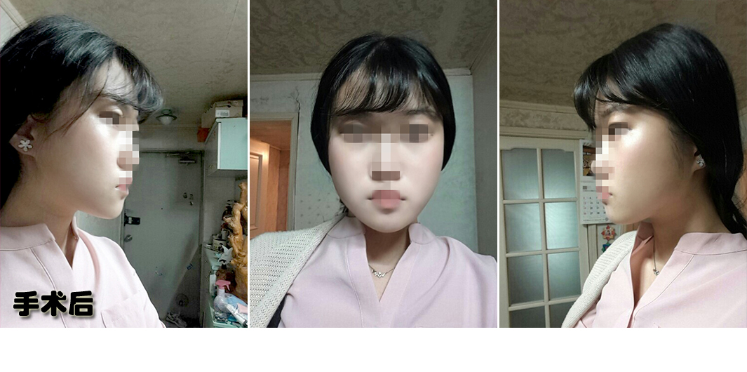강민아 후.jpg