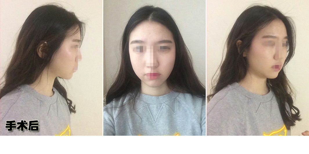 구도희 후.jpg