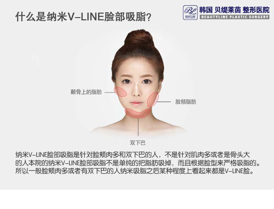 나노V라인포스팅.jpg