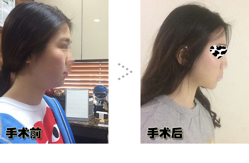 구도희 전후.jpg