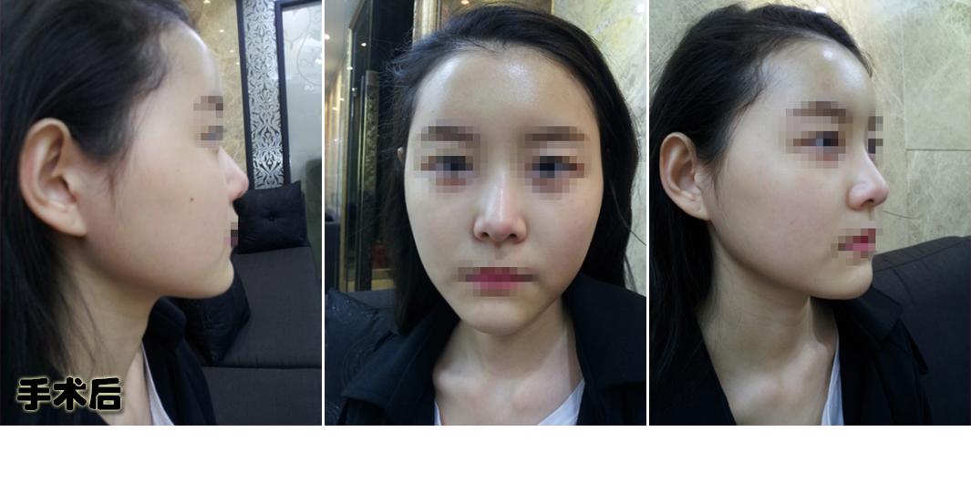 김솔_후.jpg